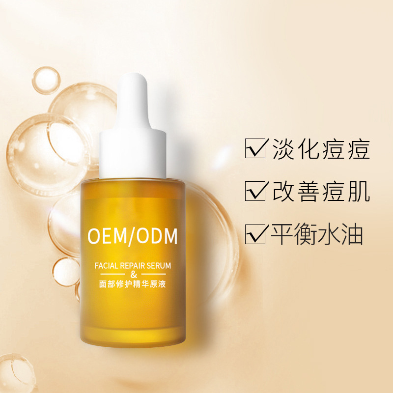 贵州_祛痘精华原液OEM
